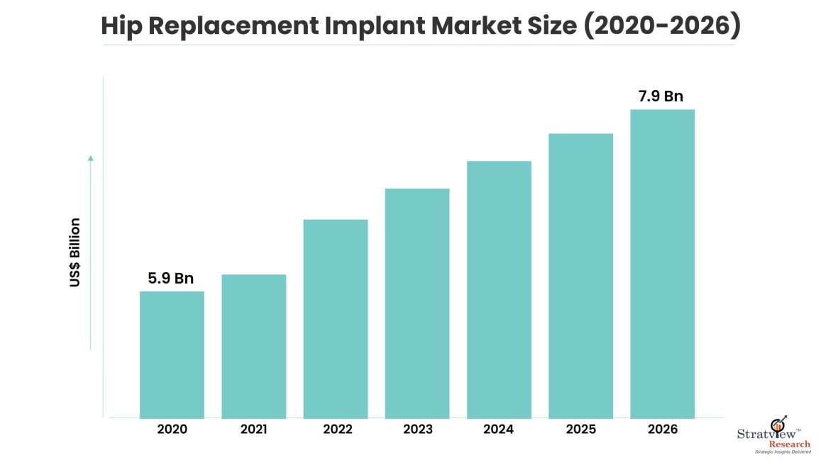 Hip Replacement Implant Market Size
